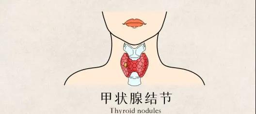 微信图片_20211112093744.jpg 微信图片_20211112093744.jpg