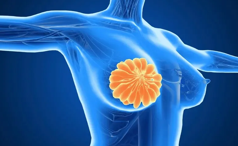颠覆认知!90.5%乳腺癌患者肿瘤大幅缩小或消失,新组合疗法震撼欧洲肿瘤大会!