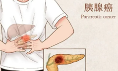 免疫疗法+新一代KRAS“多靶点”靶向药，胰腺癌治疗有望迎来突破性进展！
